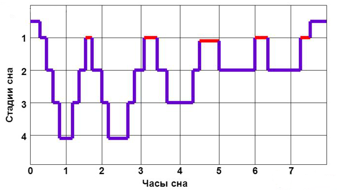 График REM-фаз сна человека, фазы быстрых движений глаз, БДГ-фазы сна, в которых можно входить в осознанное сновидение.